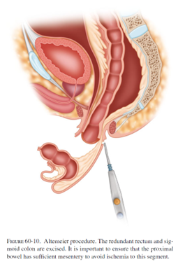 ALT-PROCEDURE-10.png ALT-PROCEDURE-10.png