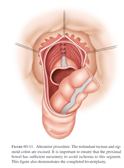 ALT-PROCEDURE-11.png ALT-PROCEDURE-11.png