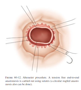 ALT-PROCEDURE-12.png ALT-PROCEDURE-12.png