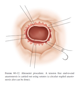 ALT-PROCEDURE-12.png