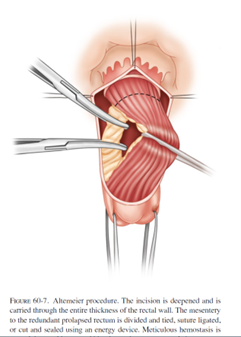 ALT-PROCEDURE-7.png ALT-PROCEDURE-7.png